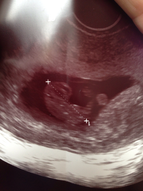 ImageUploadedByBV Forum1404639351.758607.jpg