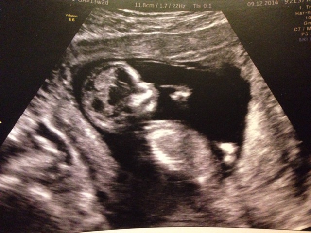 ImageUploadedByBV Forum1418168483.634714.jpg