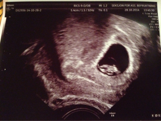 ImageUploadedByBV Forum1419719080.402101.jpg