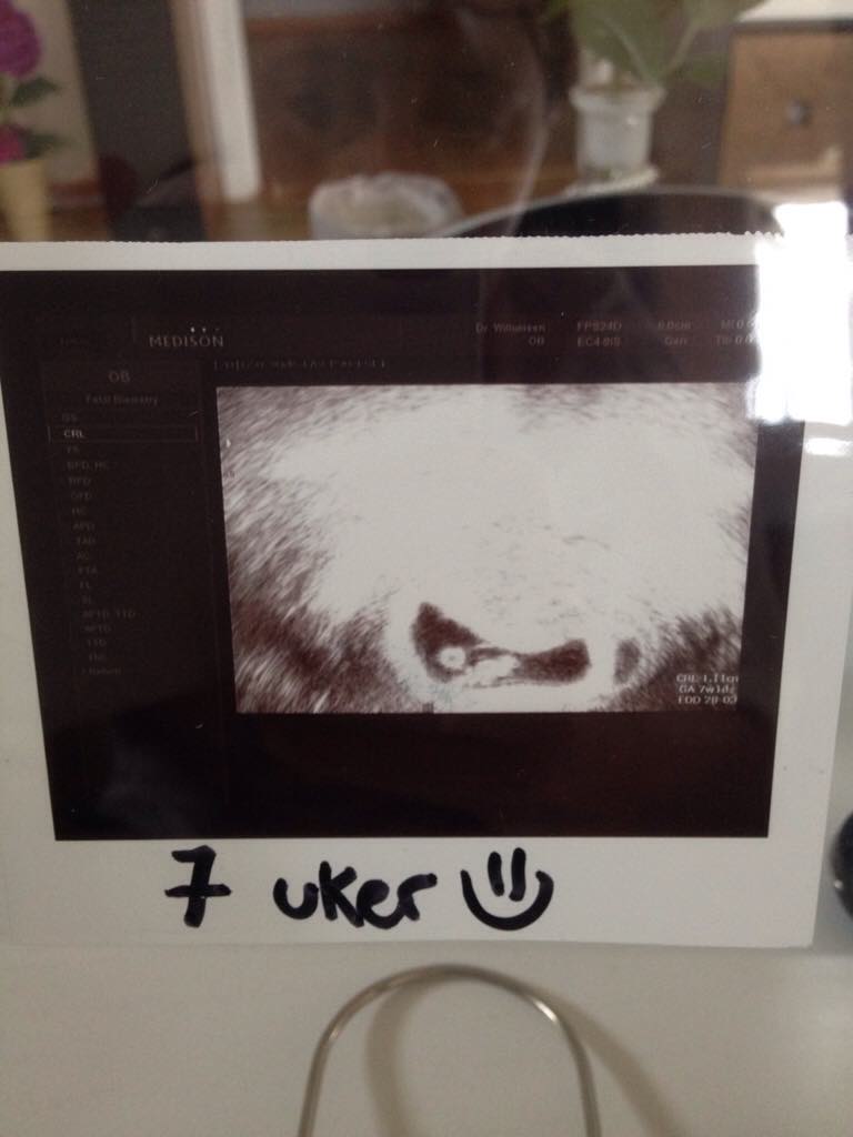 ImageUploadedByBV Forum1439280277.662654.jpg