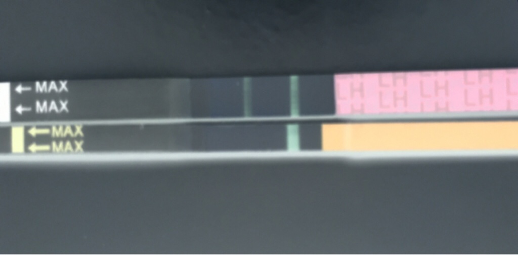 ImageUploadedByBV Forum1449511161.172772.jpg