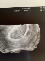 39BB9313-AB57-48FB-A001-FEF599004D35.jpeg 39BB9313-AB57-48FB-A001-FEF599004D35.jpeg