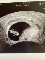 D5FF9EEE-0549-4F84-8D5C-984DC93D14EB.jpeg D5FF9EEE-0549-4F84-8D5C-984DC93D14EB.jpeg