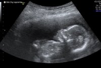 download (1).jpeg download (1).jpeg