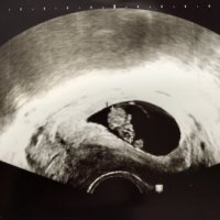 94D346F3-4285-40FD-B485-9CEF81CEC102.jpeg 94D346F3-4285-40FD-B485-9CEF81CEC102.jpeg