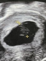 79EC29E0-741B-4F0A-A1EE-A7BDB6079E12.jpeg 79EC29E0-741B-4F0A-A1EE-A7BDB6079E12.jpeg