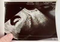 94DEDA21-9AC8-4360-80DC-79B9D7D29555.jpeg 94DEDA21-9AC8-4360-80DC-79B9D7D29555.jpeg