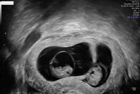 2427807D-3A9A-4758-B937-B73E4FD82A6E.jpeg 2427807D-3A9A-4758-B937-B73E4FD82A6E.jpeg