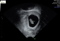 71127B66-3118-4D02-BE02-A8D10666E076.jpeg 71127B66-3118-4D02-BE02-A8D10666E076.jpeg