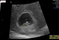 A0120933-E967-436D-A9EE-C7247721E95E.jpeg A0120933-E967-436D-A9EE-C7247721E95E.jpeg