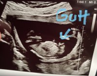 85BE944C-AFDB-4BF6-832A-FB14B384FC1F.jpeg 85BE944C-AFDB-4BF6-832A-FB14B384FC1F.jpeg