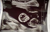 3DD3E675-2AD1-40DB-9332-C30E2F1E709C.jpeg 3DD3E675-2AD1-40DB-9332-C30E2F1E709C.jpeg