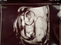 96252FA9-5EBD-45B6-BCF9-697EC3955E2A.jpeg 96252FA9-5EBD-45B6-BCF9-697EC3955E2A.jpeg