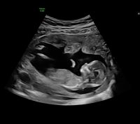 491F1511-8EB6-41B5-8DB2-BF97E8F1AB81.jpeg 491F1511-8EB6-41B5-8DB2-BF97E8F1AB81.jpeg