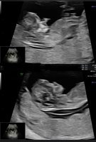 968613B6-3411-4AF0-A2FE-F8E12683DAE4.jpeg 968613B6-3411-4AF0-A2FE-F8E12683DAE4.jpeg