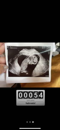 3CC62440-FCAC-4EBB-B825-C32D480D0583.png 3CC62440-FCAC-4EBB-B825-C32D480D0583.png