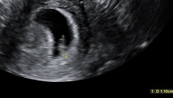 D12E4410-D3B6-4479-82DC-2832C63E8271.jpeg D12E4410-D3B6-4479-82DC-2832C63E8271.jpeg