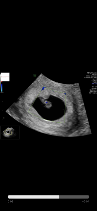 1A47A422-D9D6-46E4-96F5-1EB82DF846B8.png 1A47A422-D9D6-46E4-96F5-1EB82DF846B8.png