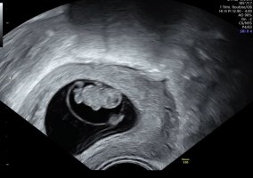 20200428_133929.jpg 20200428_133929.jpg