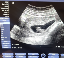 1673004925205.png 1673004925205.png