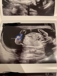 97197C98-67CD-4846-8E90-2D374EEBF02D.jpeg 97197C98-67CD-4846-8E90-2D374EEBF02D.jpeg