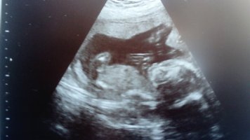 1488888141819.jpg 1488888141819.jpg