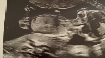 A58176EE-5084-4555-B40C-059AF762A501.jpeg A58176EE-5084-4555-B40C-059AF762A501.jpeg