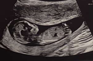 IMG_9526.jpeg IMG_9526.jpeg