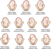 Baby_birth_positions.jpg Baby_birth_positions.jpg