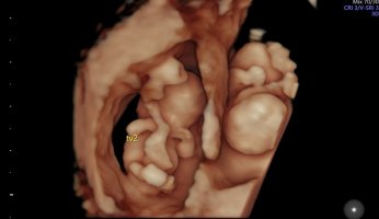 IMG_0506.jpeg IMG_0506.jpeg