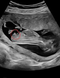 Screenshot_20230724_222322_Samsung Internet.jpg