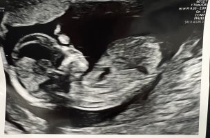 IMG_5062.jpeg IMG_5062.jpeg