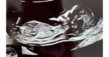 919A6CD9-A464-49E7-AEBE-B57F785A3285.jpeg 919A6CD9-A464-49E7-AEBE-B57F785A3285.jpeg