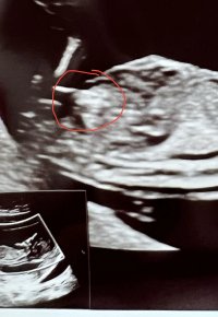 8F7230FB-0746-49FD-A14D-00C7F8E57871.jpeg 8F7230FB-0746-49FD-A14D-00C7F8E57871.jpeg