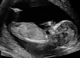 1.2.276.0.26.1.1.1.2.2023.256.37688.7666401.92012544.jpg 1.2.276.0.26.1.1.1.2.2023.256.37688.7666401.92012544.jpg