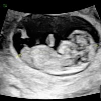 IMG_0401.jpeg IMG_0401.jpeg