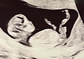 EFF197D7-B6DD-4D18-9448-8E4443E6A4DB.jpeg EFF197D7-B6DD-4D18-9448-8E4443E6A4DB.jpeg