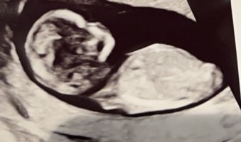 4457B8A9-0322-4EB7-B2B0-F5A62EC2B858.jpeg 4457B8A9-0322-4EB7-B2B0-F5A62EC2B858.jpeg