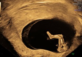 download.jpeg-1 (2)11,.jpg