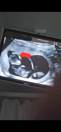 Screenshot_20231128_224006_Gallery.jpg Screenshot_20231128_224006_Gallery.jpg