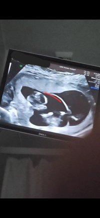 Screenshot_20231128_223753_Gallery.jpg Screenshot_20231128_223753_Gallery.jpg