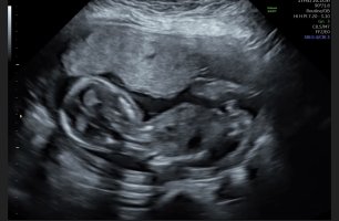 IMG_5583.jpeg IMG_5583.jpeg