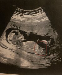 IMG_4969.jpeg IMG_4969.jpeg