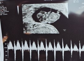 20240115_113635.jpg 20240115_113635.jpg