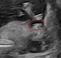 Screenshot_20240209_202748_Samsung Internet.jpg