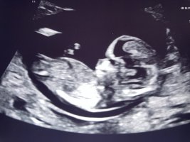 IMG_2867.jpeg IMG_2867.jpeg