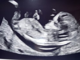 IMG_2868.jpeg IMG_2868.jpeg