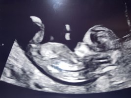 IMG_2870.jpeg IMG_2870.jpeg