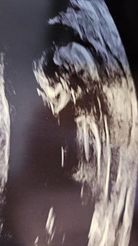 1000039429.jpg 1000039429.jpg