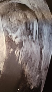 1000039428.jpg 1000039428.jpg